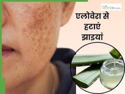 चेहरे पर एलोवेरा जेल में मिलाकर लगा लें ये 3 चीजें, एक हफ्ते में गायब हो जाएंगी झाइया