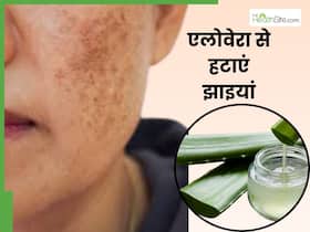 चेहरे पर एलोवेरा जेल में मिलाकर लगा लें ये 3 चीजें, एक हफ्ते में गायब हो जाएंगी झाइया