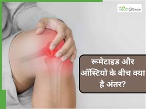रूमेटाइड अर्थराइटिस और ऑस्टियोअर्थराइटिस में क्या अंतर है? कैसे होता है दोनों का इलाज