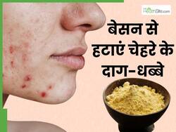 चेहरे पर बेसन में मिलाकर लगाएं ये 3 चीजें, 5 मिनट में चमक उठेगा चेहरा