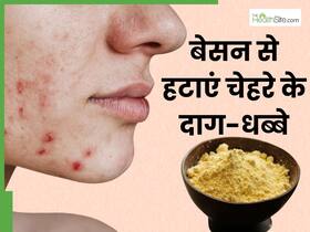चेहरे पर बेसन में मिलाकर लगाएं ये 3 चीजें, 5 मिनट में चमक उठेगा चेहरा