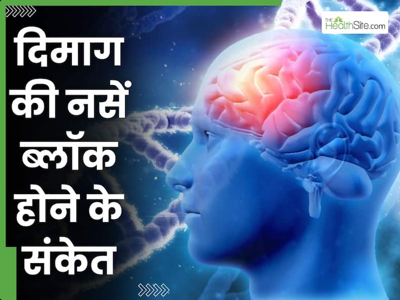 दिमाग की नसें बंद होने से 1 महीना पहले दिखायी देते हैं ये 10 संकेत, ना करें इग्नोर