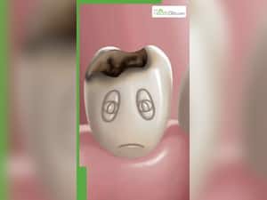 दांतों से कीड़े निकालने के लिए अपनाएं ये 7 घरेलू नुस्खे