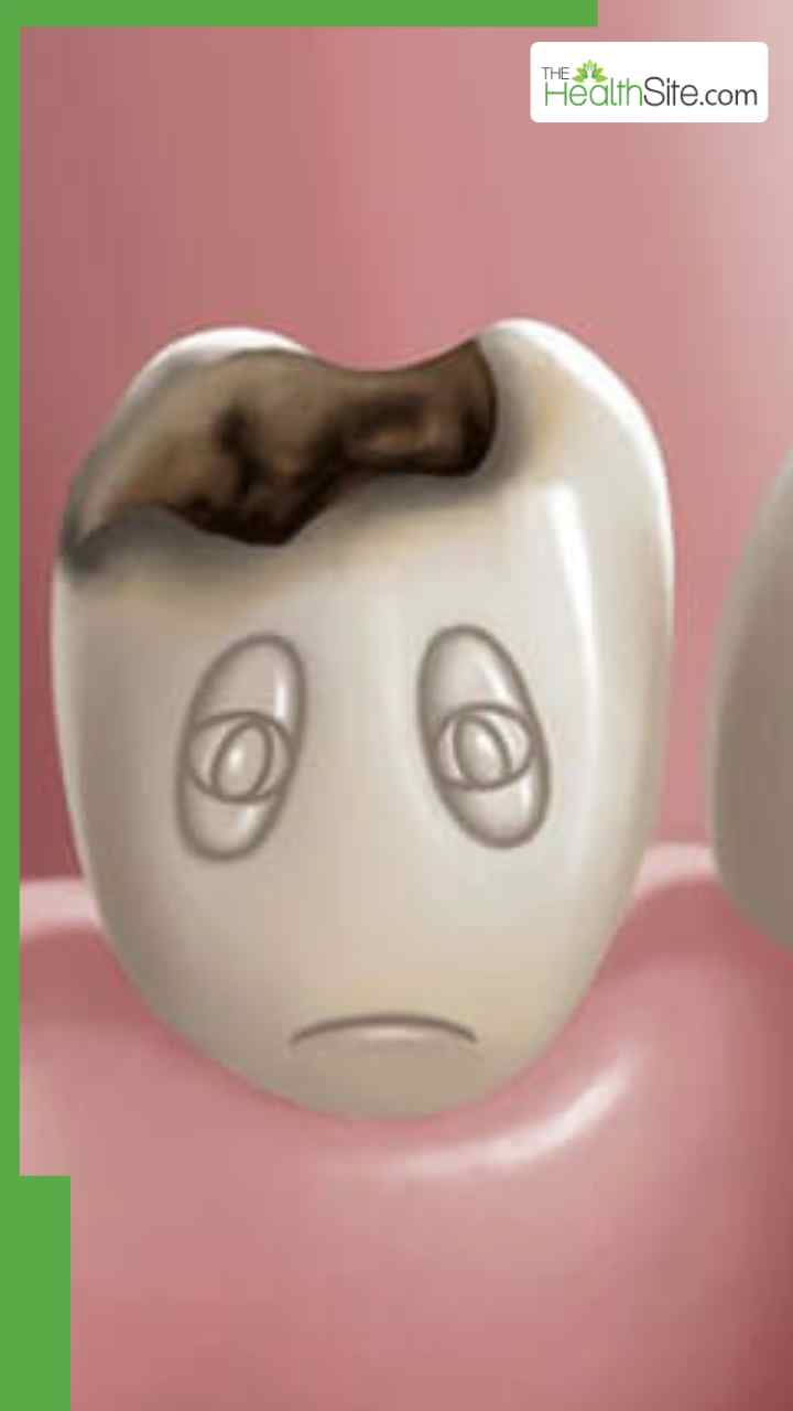 рджрд╛рдВрддреЛрдВ рд╕реЗ рдХреАрдбрд╝реЗ рдирд┐рдХрд╛рд▓рдиреЗ рдХреЗ рд▓рд┐рдП рдЕрдкрдирд╛рдПрдВ рдпреЗ 7 рдШрд░реЗрд▓реВ рдиреБрд╕реНрдЦреЗ