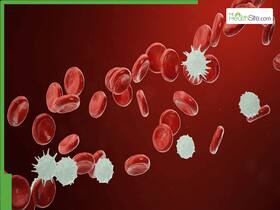 Chronic Myeloid Leukemia (CML) Treatment Management And Guidelines