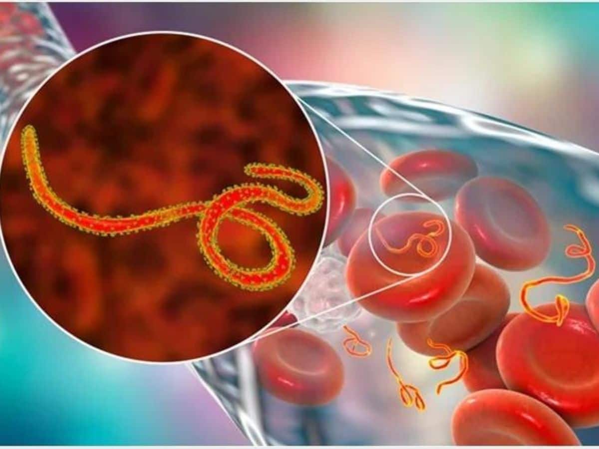 Ebola Virus