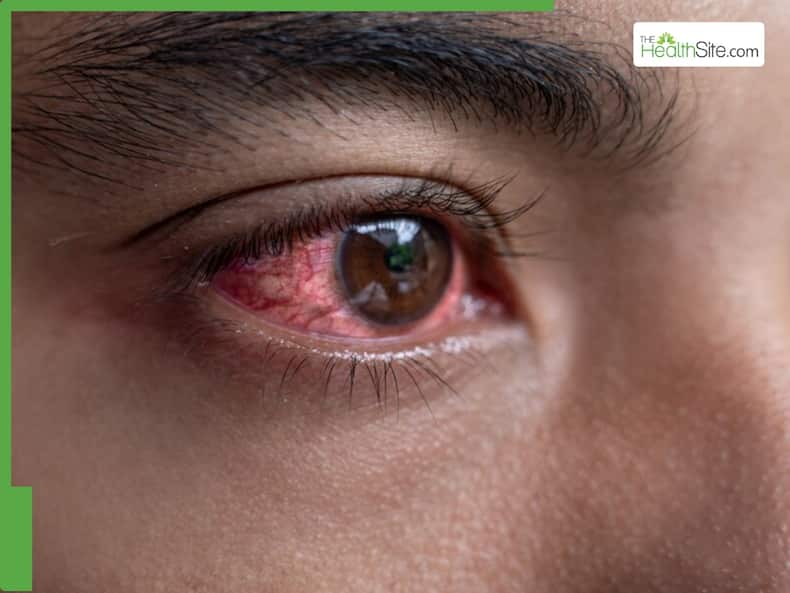 thehealthsite.com top news