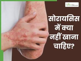 सोरायसिस होने पर भूलकर भी न खाएं ये 5 फूड्स, वरना बढ़ सकती हैं दिक्क्तें