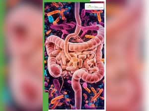 गट हेल्थ के लिए 9 बेस्ट फूड्स