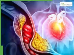 Heart Blockage Symptoms: 7 Signs of Blocked Arteries That May Appear At Night