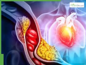 Heart Blockage Symptoms: 7 Signs of Blocked Arteries That May Appear At Night Heart Blockage Symptoms: 7 Signs of Blocked Arteries That May Appear At Night