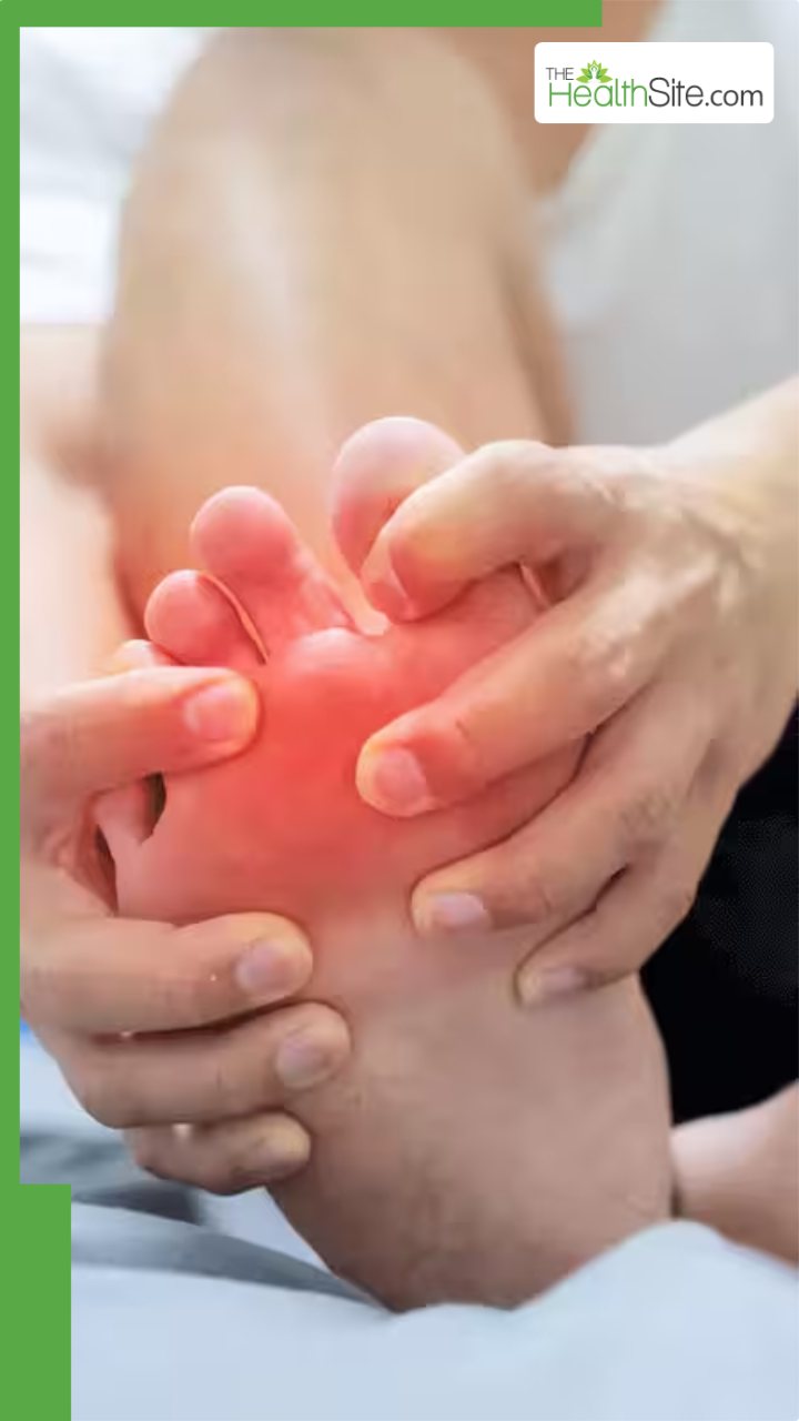 यूरिक एसिड हो गया है हाई तो इन दालों से बनाएं दूरी