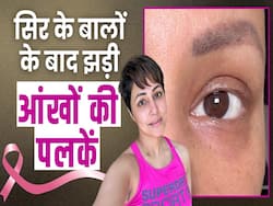 Hina Khan Health Update: कीमोथेरेपी के बाद हिना खान की झड़ीं आंखों की पलकें!
