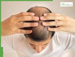 Homeopathy For Hair Loss: Dr Batra's Explains Psychological Effects of Alopecia