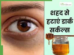 डार्क सर्कल्स हटाने के लिए शहद में मिलाकर लगाएं ये 3 चीजें, तुरंत दिखेगा असर