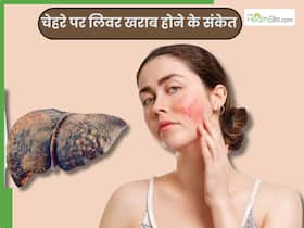 लिवर डैमेज होने से पहले चेहरे पर दिखाई देते हैं ये 5 लक्षण, हर व्यक्ति करता है नजरअंदाज लिवर डैमेज होने से पहले चेहरे पर दिखाई देते हैं ये 5 लक्षण, हर व्यक्ति करता है नजरअंदाज