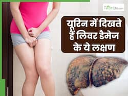 लिवर में खराबी होने पर पेशाब में दिखते हैं ये 5 संकेत, 90 फीसदी लोग साधारण समझकर करते हैं इग्नोर