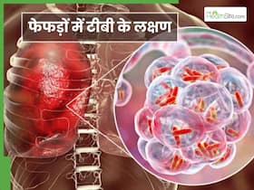 फेफड़ों में टीबी की शुरुआत होते ही दिखने लगते हैं ये 5 लक्षण, इग्नोर करने से डैमेज हो सकती हैं Lungs फेफड़ों में टीबी की शुरुआत होते ही दिखने लगते हैं ये 5 लक्षण, इग्नोर करने से डैमेज हो सकती हैं Lungs
