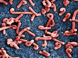 Marburg Virus: Rwanda Kicks Off Vaccination Campaign As Death Toll Increases To 12