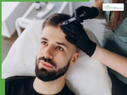 Mesotherapy For Men: Exploring The Best Hair Loss Solutions For Men