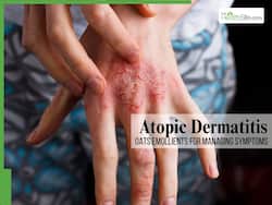 7 Surprising Benefits of Oats Emollients for Managing Atopic Dermatitis Symptoms