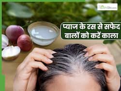 प्याज के रस में मिलाकर लगाएं ये 2 चीजें, 1 हफ्ते में जड़ से काले हो जाएंगे सफेद बाल