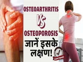 World Osteoporosis Day: ऑस्टियोआर्थराइटिस और ऑस्टियोपोरोसिस में क्या है फर्क? World Osteoporosis Day: ऑस्टियोआर्थराइटिस और ऑस्टियोपोरोसिस में क्या है फर्क?