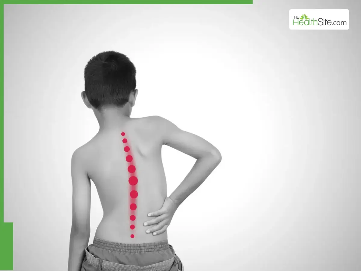 Treating scoliosis and other spinal conditions in children and adolescents