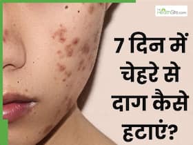 7 दिन में चेहरे के दाग धब्बे हटाने के लिए अपनाएं ये 5 में से 1 नुस्खे, स्किन पर मिनटों में चमक