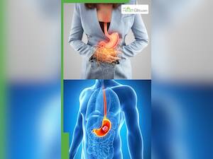 पेट का कैंसर होने पर दिखाई देते हैं ये 7 लक्षण