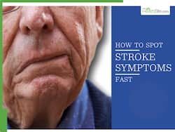 Stroke Symptoms: 7 Signs On Face That May Appear Due To Loss of Blood Flow To Brain
