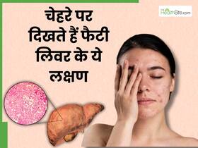 फैटी लिवर की समस्या में चेहरे पर दिखाई देते हैं ये 4 लक्षण, तुरंत जाएं डॉक्टर के पास फैटी लिवर की समस्या में चेहरे पर दिखाई देते हैं ये 4 लक्षण, तुरंत जाएं डॉक्टर के पास
