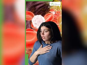 कोलेस्ट्रॉल बढ़ने पर नजर आते हैं ये 8 लक्षण