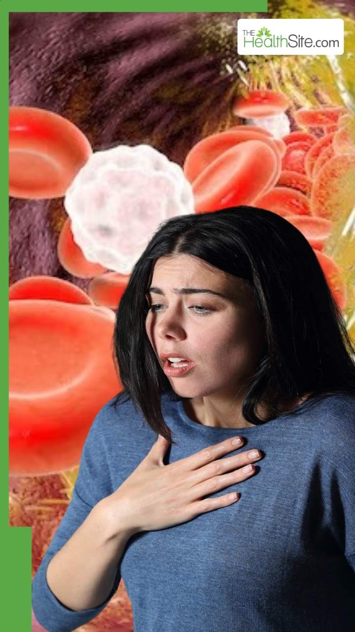 कोलेस्ट्रॉल बढ़ने पर नजर आते हैं ये 8 लक्षण