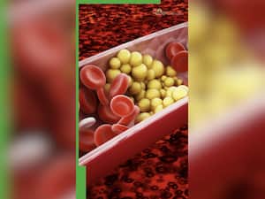 उम्र के हिसाब से कितना होना चाहिए ट्राइग्लिसराइड्स?