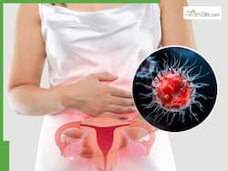 Vaginal Cancer Symptoms: Pink Discharge, Smelly Vagina; 5 Signs You Shouldn't Ignore