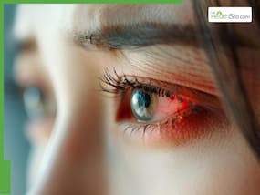 Diwali Pollution: Best Ways To Manage Allergies And Eye Irritation During Diwali