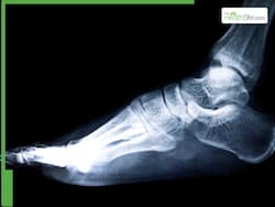 Retired Army Man Needed Major Surgery For Ankle Pain; But Doctors Did This Instead...