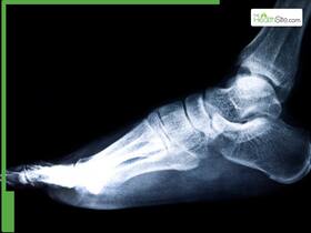 Retired Army Man Needed Major Surgery For Ankle Pain; But Doctors Did This Instead...