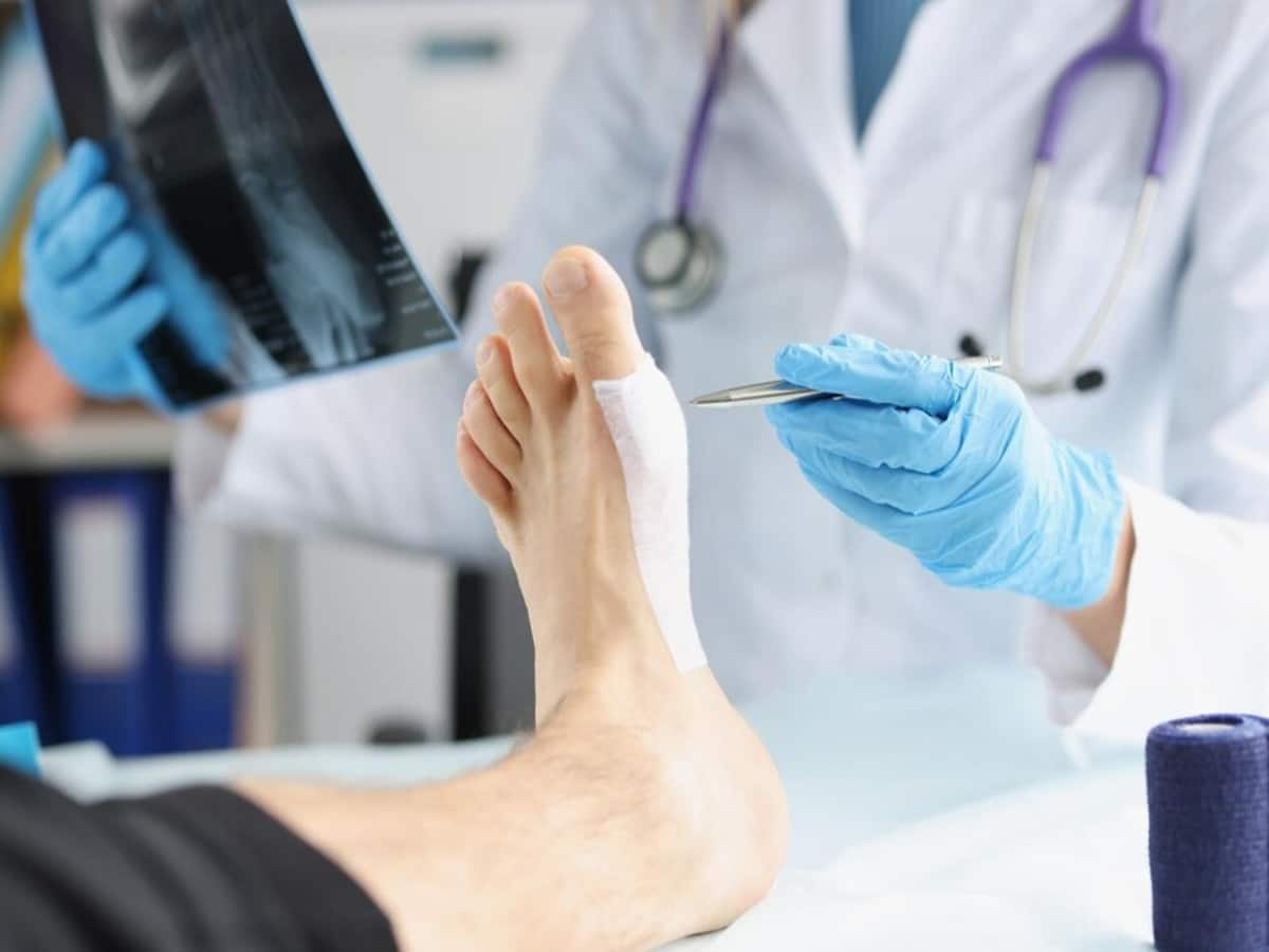 Ankle injury, Ankle bone, Major surgeries, Minimally Invasive Surgeries, case study, medical case, ankle arthroscopy procedure, ankle replacement surgery