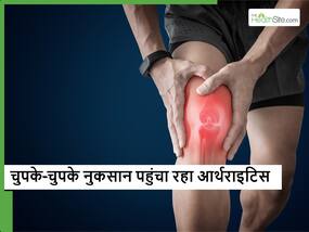 चुपके-चुपके आपकी डेली लाइफ को प्रभावित कर रहा आर्थराइटिस, एक्सपर्ट्स ने किया सावधान
