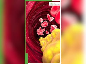 कोलेस्ट्रॉल कंट्रोल करने के लिए खाएं ये 8 चीजें