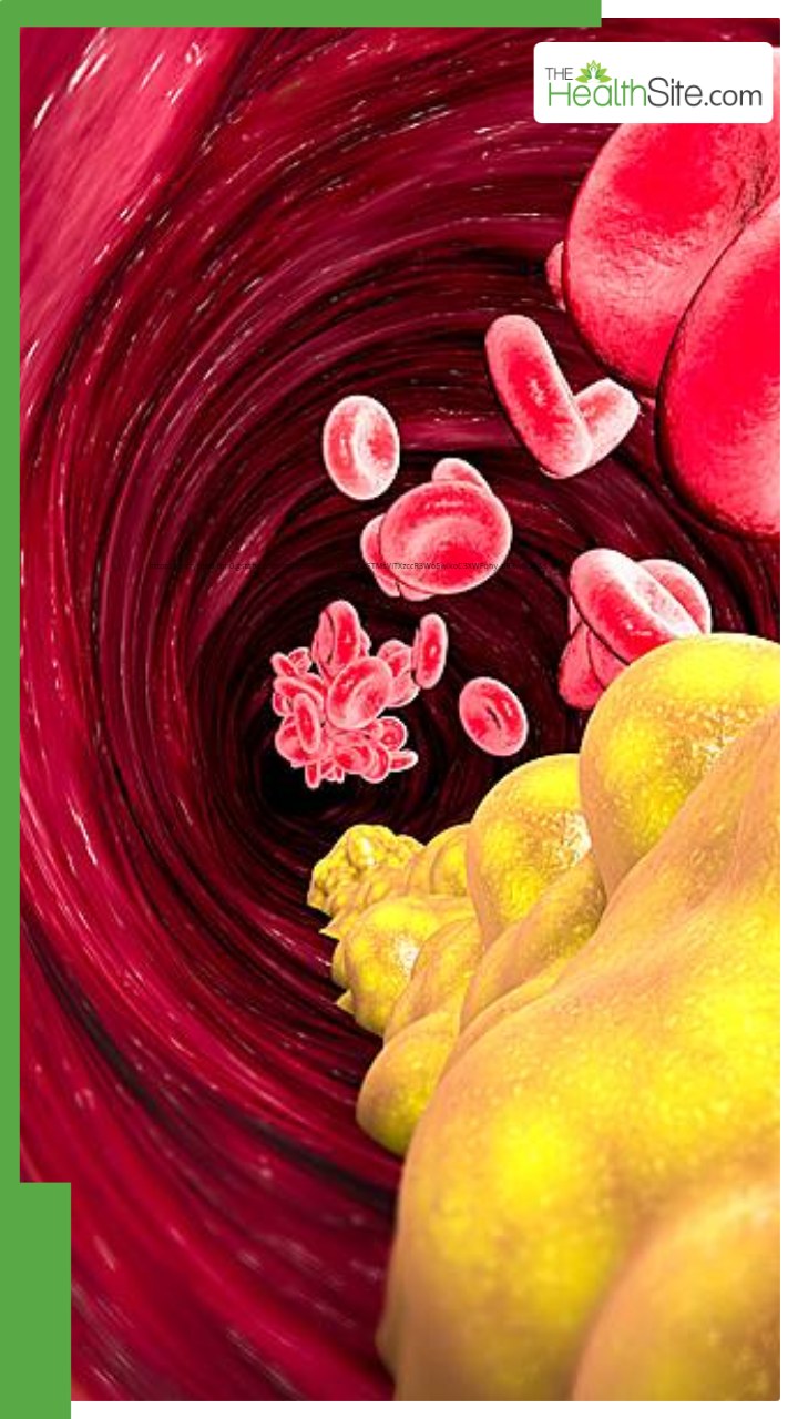 कोलेस्ट्रॉल कंट्रोल करने के लिए खाएं ये 8 चीजें