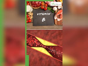 बैड कोलेस्ट्रॉल को कम करते हैं ये फूड्स