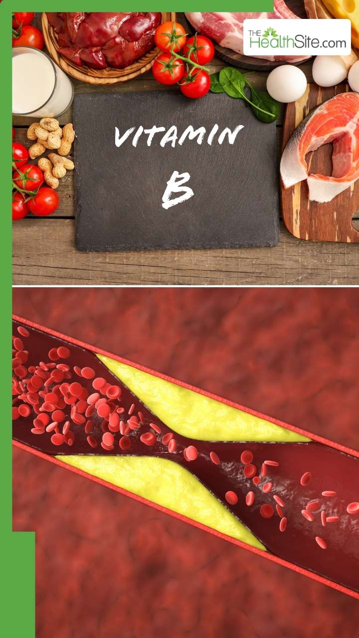 बैड कोलेस्ट्रॉल को कम करते हैं ये फूड्स