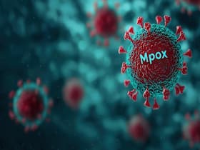 Uganda Confirms First Mpox Death; Infections Hit 164 Uganda Confirms First Mpox Death; Infections Hit 164