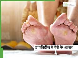 डायबिटीज में 70 प्रतिशत लोगों की मौत का कारण है पैर का अल्सर, क्या सावधानी जरूरी