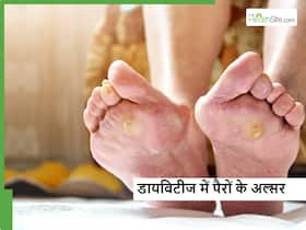 डायबिटीज में 70 प्रतिशत लोगों की मौत का कारण है पैर का अल्सर, क्या सावधानी जरूरी