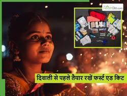 Diwali Safety: दिवाली में हाथ-पैर जलने का रहता है खतरा, घर पर जरूर रखें ये चीजें