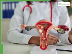 After 5 Years Of Struggle, 29-Year-Old Woman Treated For Severe Endometriosis